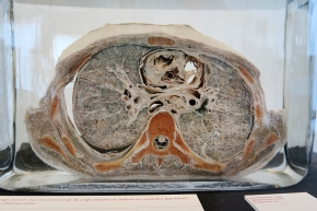 geneeskundemuseum brussel 8-2025 3153